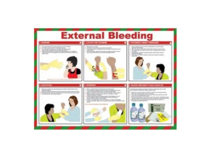 External bleeding poster