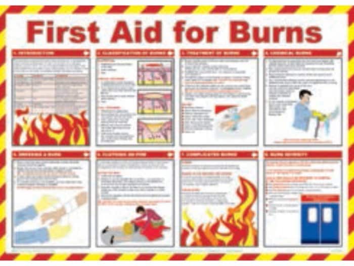 First aid for burns poster